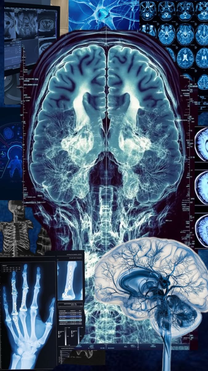 A collage of medical scans showing MRI cross-sections of a brain alongside skeletal X-rays
